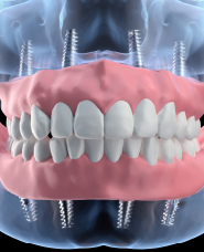 3D dental images